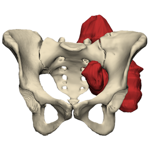 Ortho Oncology